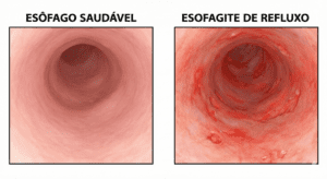 imagem do esôfago